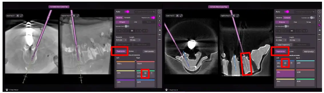 NUVASIVE-5050310-Pulse-Cios-Navigation-fig-18