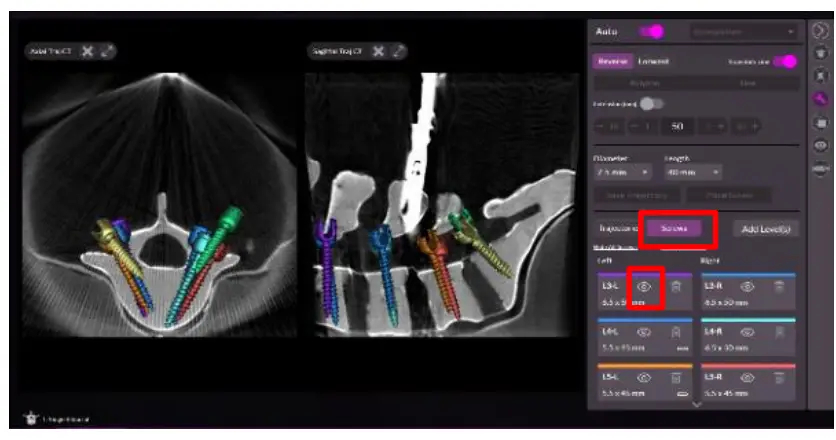 NUVASIVE-5050310-Pulse-Cios-Navigation-fig-19