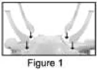 Installation Instructions