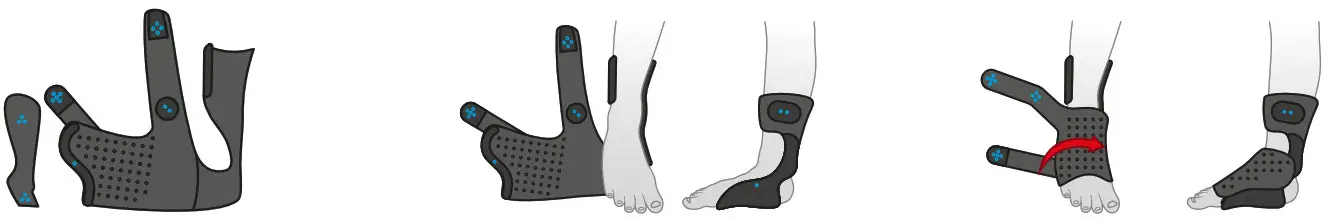 AIRCAST ACTYFOOT Ankle Brace - 1