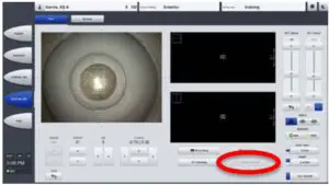 Fig 9 Capture and Review