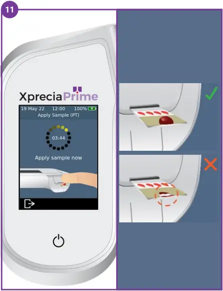 XpreciaPrime Coagulation Analyzer B11