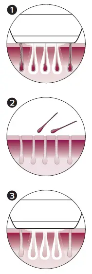 PHILIPS-BRI944-Lumea-IPL-Prestige-Hair-Removal-Device-05