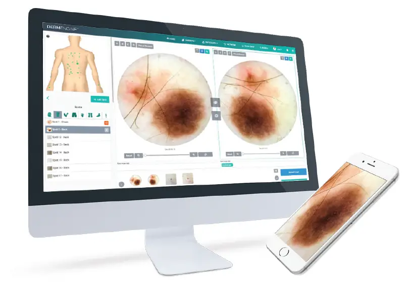 MoleScope P002-004-QSGB Phone Camera FIG 6