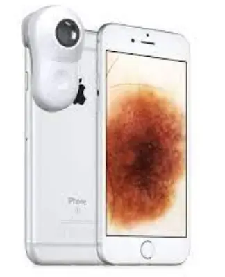 MoleScope P002-004-QSGB Phone Camera PRODUCT