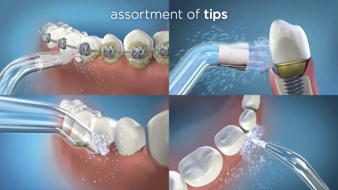 Waterpik Wp-100 Water Flosser User Guide Waterpik Wp-100 Water Flosser User Guide