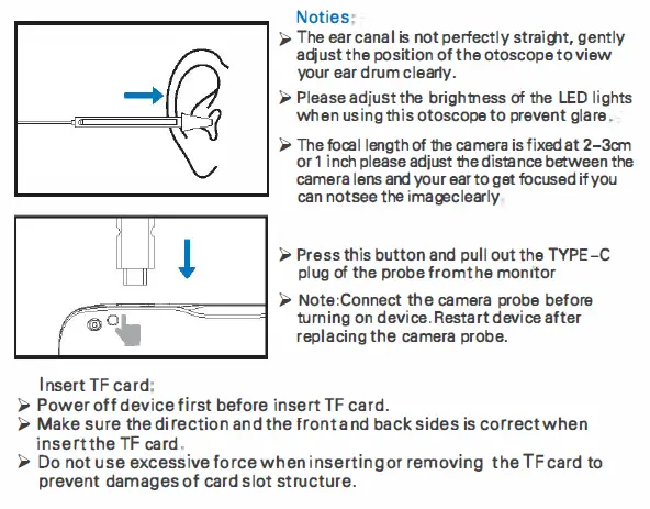 ANYKIT MS450 Digital Otoscope Camera - Copy