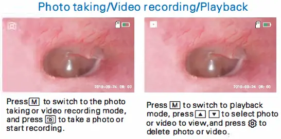 ANYKIT MS450 Digital Otoscope Camera - Copy