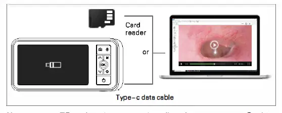 ANYKIT MS450 Digital Otoscope Camera - Copy