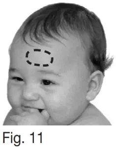 beurer FT 85 Non Contact Thermometer - FIG8