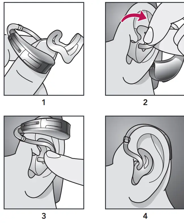 Starkey BTE 13 Livio 1000 Hearing Aid - Fig2