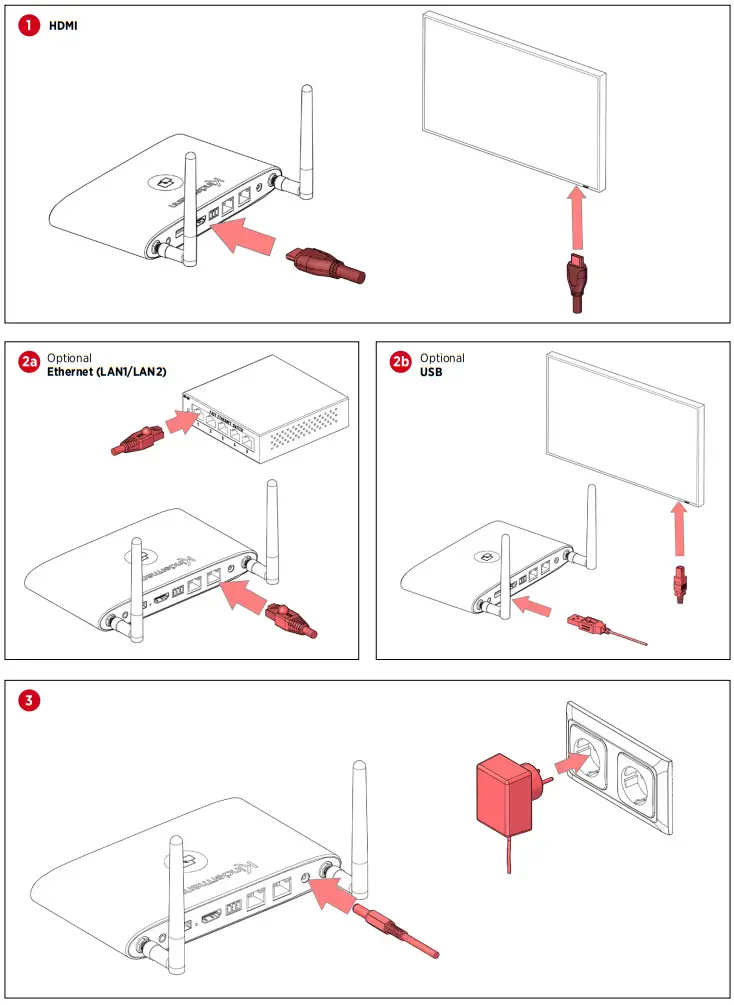 Kindermann KLICK and SHOW K 42U Kit - fig 3
