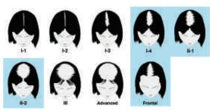 Hairmax 41 LaserBand comfortflex - fig 12