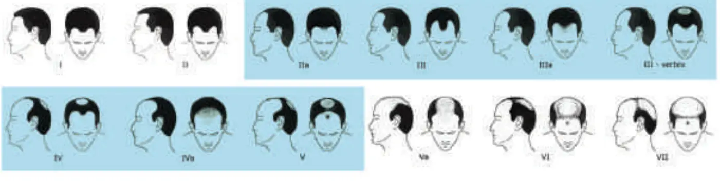 Hairmax 41 LaserBand comfortflex - fig 13