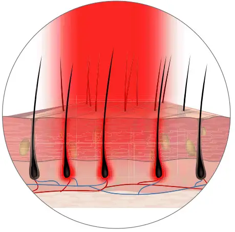 Hairmax 41 LaserBand comfortflex - fig 14