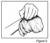 Peel off the wax from the treated area Fig 5