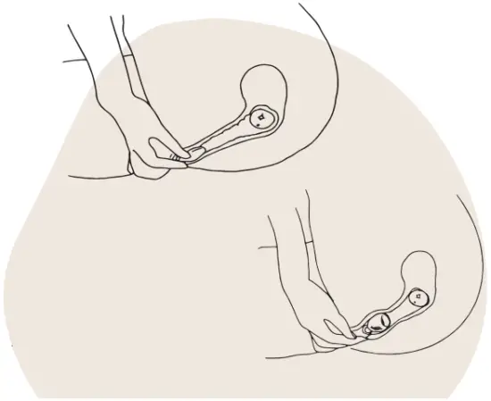 FEMMYCYCLE 416330 Reusable Menstrual Cup - FIG 2