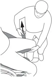 Sitting position - Removing the sling