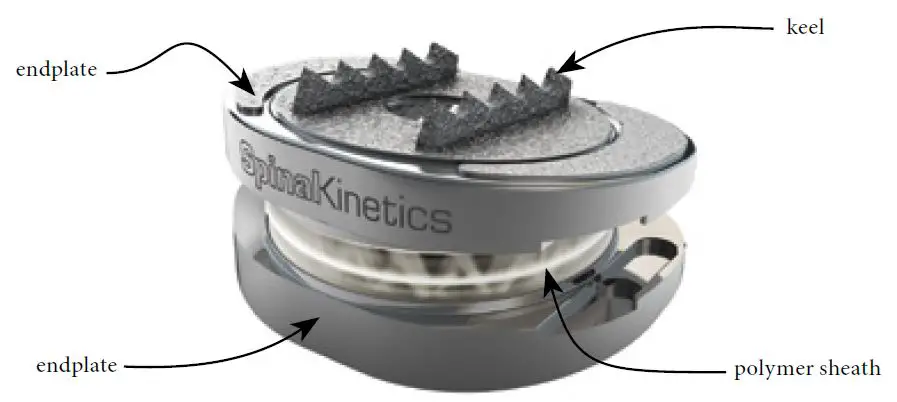 Orthofix M6-L SpinalKinetics Artificial Lumber fig 1
