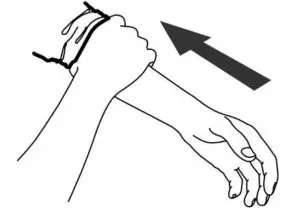 Applying the Wrist Cuff Fig 1