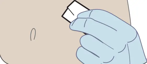 Dexcom G6 Pro Glucose Monitoring System - Fig 1