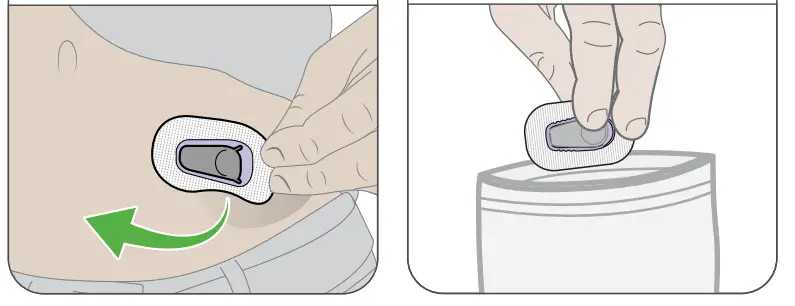 Dexcom G6 Pro Glucose Monitoring System - Fig 12