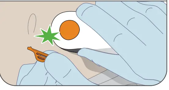 Dexcom G6 Pro Glucose Monitoring System - Fig 4