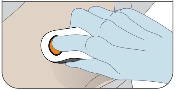 Dexcom G6 Pro Glucose Monitoring System - Fig 5