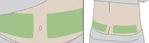 Dexcom G6 Pro Glucose Monitoring System - Fig