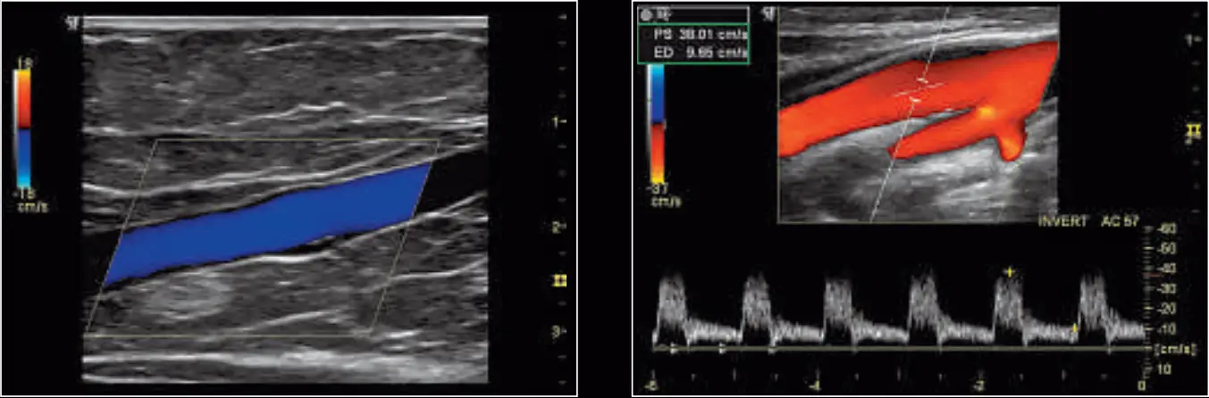 GE Healthcare Logiq P6 3D Ultrasound Machine - Fig 10