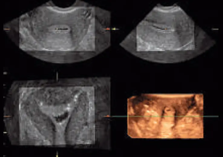 GE Healthcare Logiq P6 3D Ultrasound Machine - Fig 4