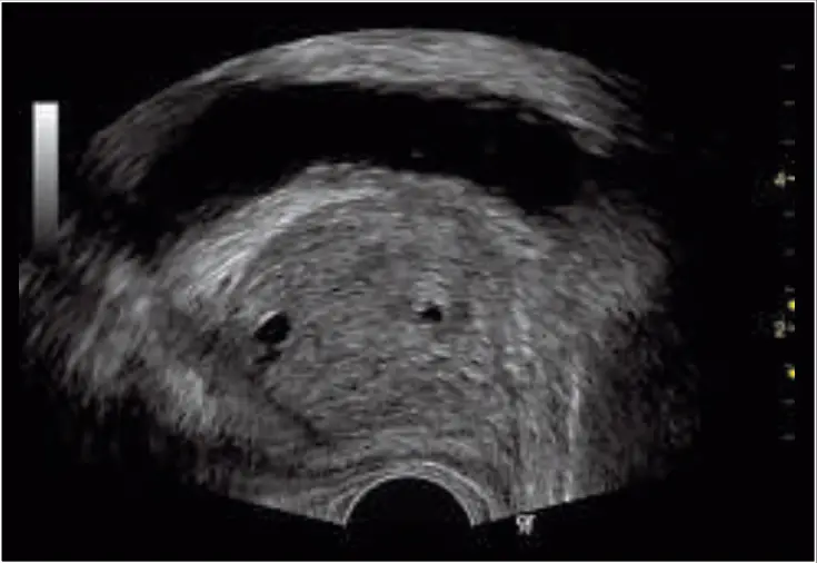 GE Healthcare Logiq P6 3D Ultrasound Machine - Fig 5