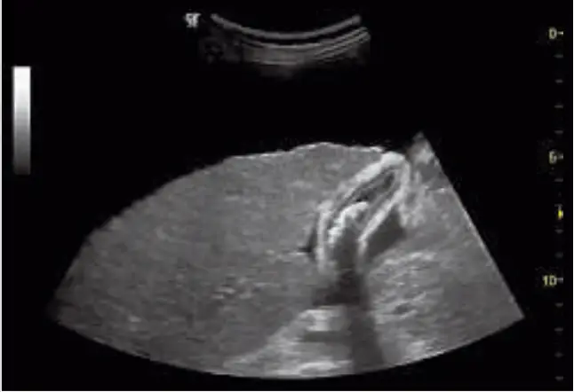 GE Healthcare Logiq P6 3D Ultrasound Machine - Fig 7