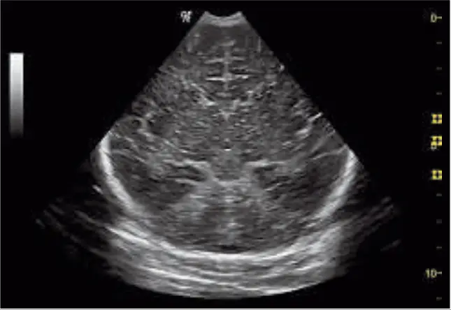 GE Healthcare Logiq P6 3D Ultrasound Machine - Fig 8
