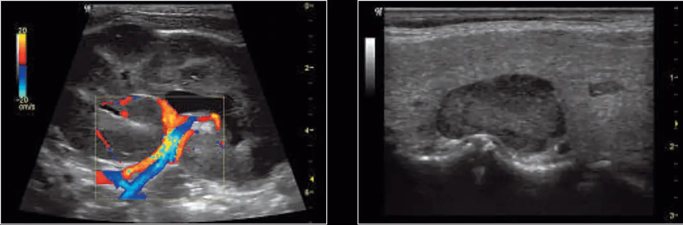 GE Healthcare Logiq P6 3D Ultrasound Machine - Fig 9
