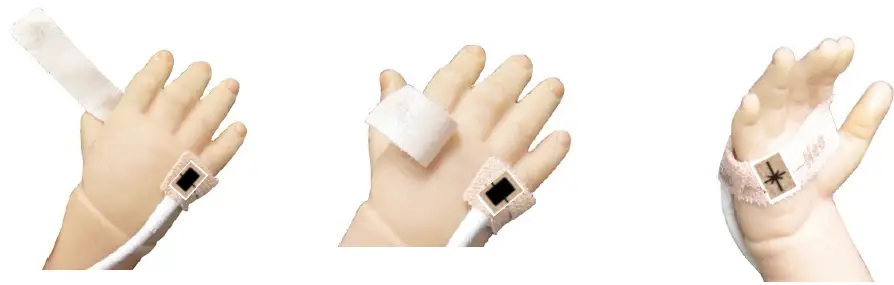 Masimo-LNCS-Neo-Sensor-Application-Hand-FIG-1
