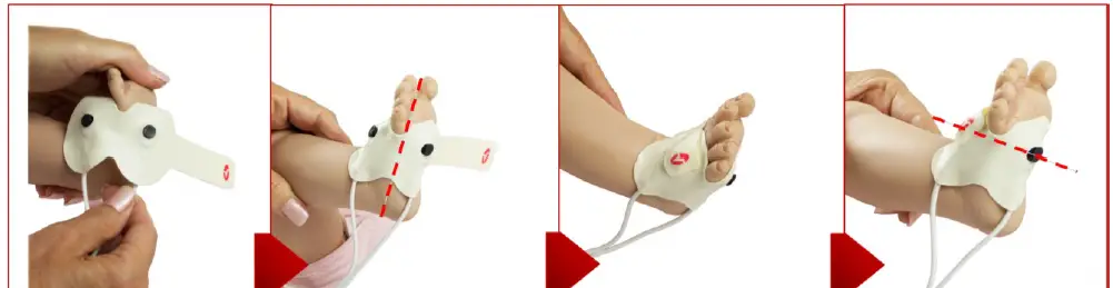 Masimo-LNCS-Neo-Sensor-Application-Hand-FIG-15