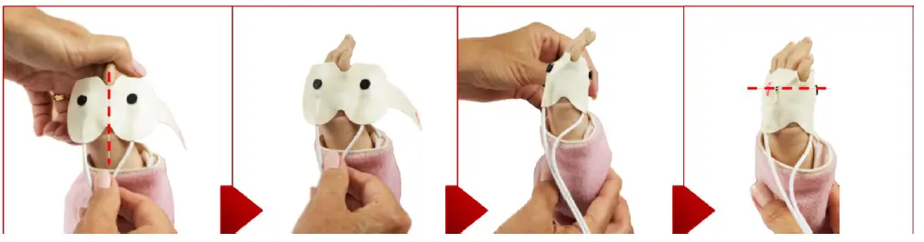 Masimo LNCS Y-I Sensor Hand Application