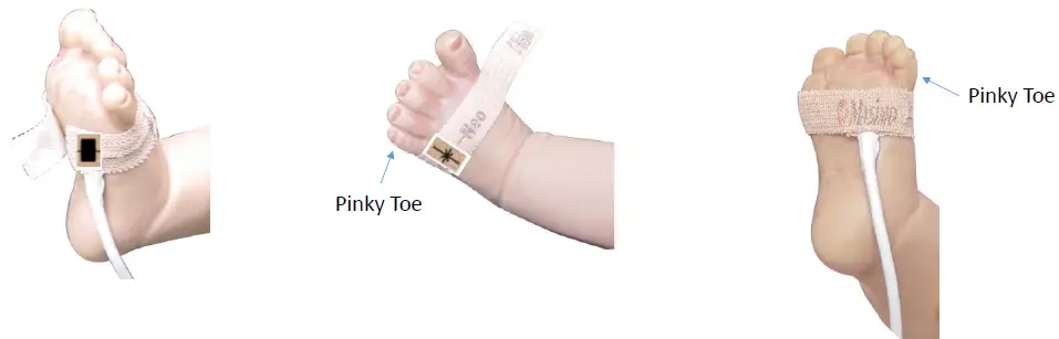 Masimo-LNCS-Neo-Sensor-Application-Hand-FIG-4