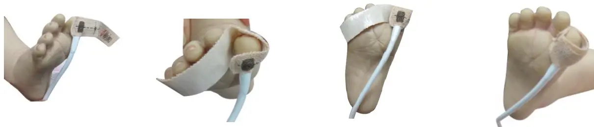 Masimo-LNCS-Neo-Sensor-Application-Hand-FIG-9