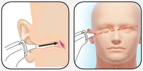 BRAUN ThermoScan Ear Thermometer 1