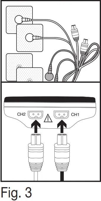 beurer Digital EMS TENS unit - Initial use 1