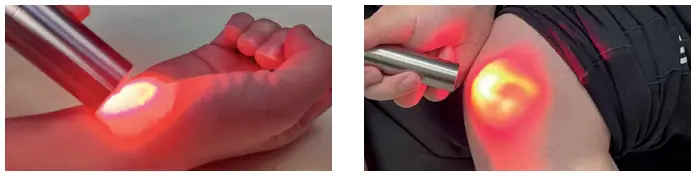 MEDIC-THERAPEUTICS-Red-Light-Therapy-fig-3