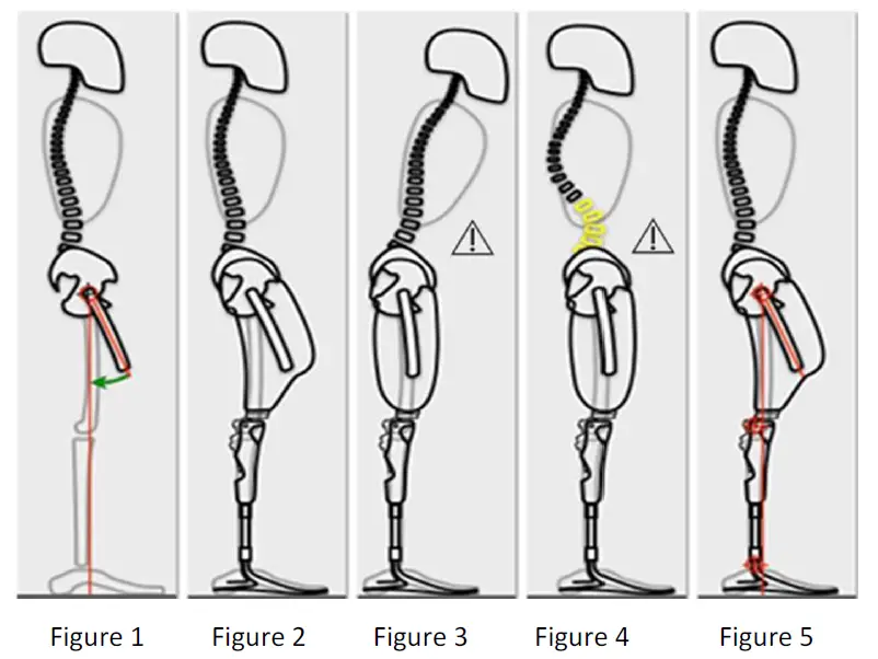 PROTEOR PLIE 3 Microprocessor Knee 7