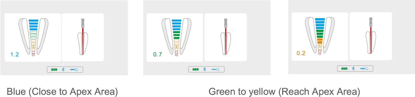 Apex Enlargement Area 01