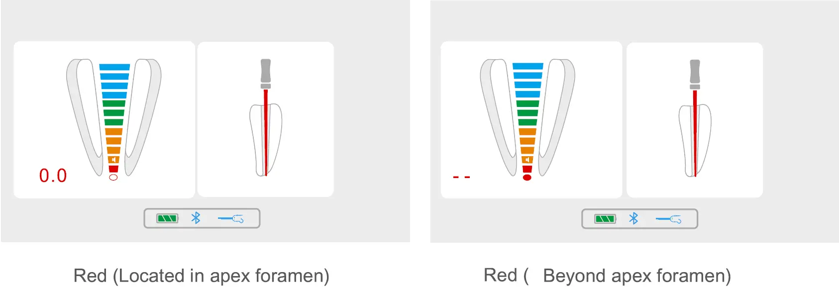 Apex Enlargement Area 02