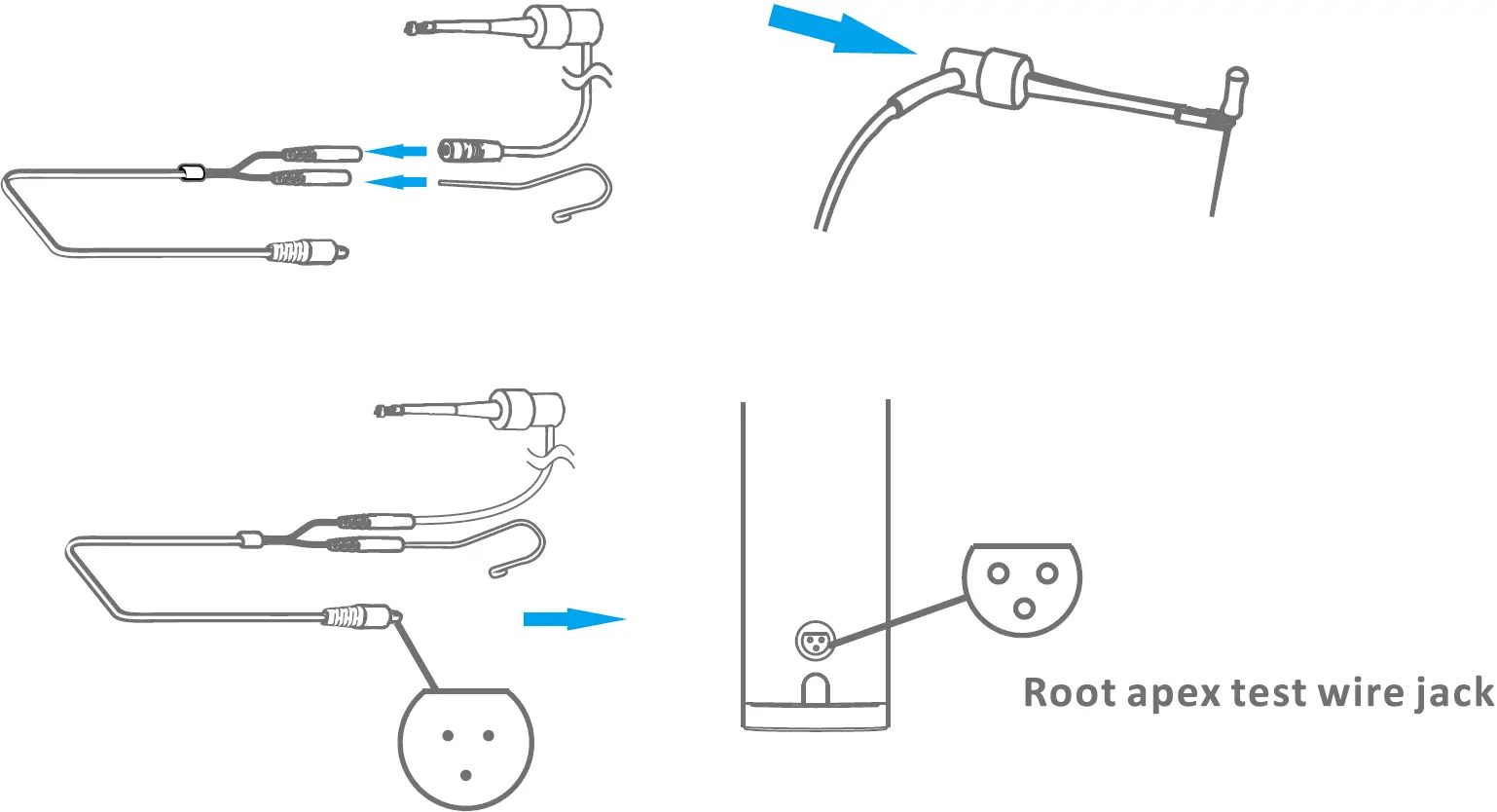Apex Locator Mode - Connection Accessories