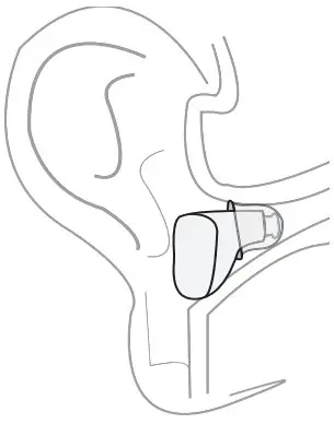beurer HA 60 Hearing Amplifiers - indicates