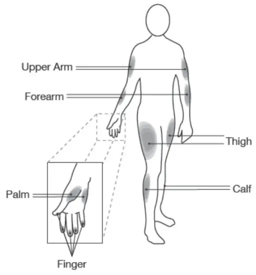iHealth BG1S Wireless Smart Glucose Meter - alternate
