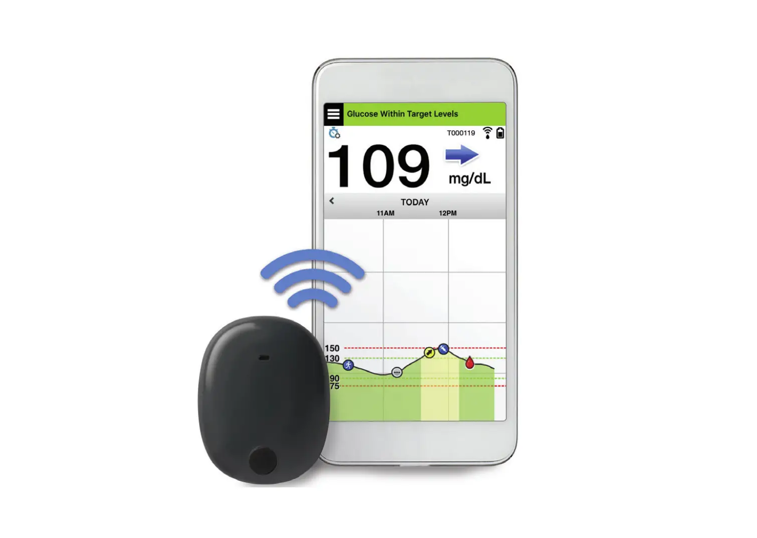 Eversense Xl Continuous Glucose Monitoring System User Guide Eversense Xl Continuous Glucose Monitoring System User Guide